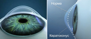 Как опрелеить болезнь глаз