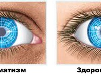 Отличие здорового глаза